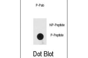 Dot Blot (DB) image for anti-Protein Kinase, Interferon-Inducible Double Stranded RNA Dependent Activator (PRKRA) (pSer246) antibody (ABIN3001881) (PRKRA 抗体  (pSer246))