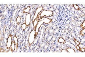 Detection of NGAL in Rat Kidney Tissue using Monoclonal Antibody to Neutrophil gelatinase-associated lipocalin (NGAL)