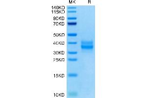 SDS-PAGE (SDS) image for Folate Receptor 1 (Adult) (FOLR1) (AA 25-232) protein (His tag) (ABIN7274669)