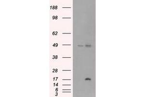 Image no. 1 for anti-Cancer/testis Antigen 1B (CTAG1B) antibody (ABIN1499904) (CTAG1B 抗体)