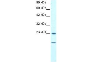 WB Suggested Anti-HSPB1 Antibody Titration:  1. (HSP27 抗体  (C-Term))