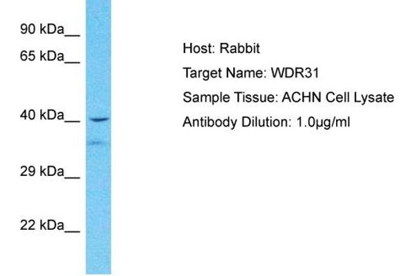 WDR31 抗体  (Middle Region)