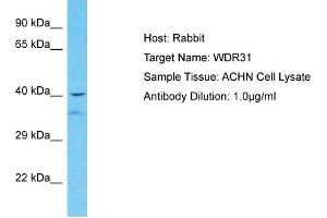 Host: Rabbit Target Name: WDR31 Sample Tissue: Human ACHN Whole Cell  Antibody Dilution: 1ug/ml (WDR31 抗体  (Middle Region))