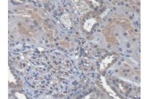 Immunohistochemistry (IHC) image for anti-Chemokine (C-X-C Motif) Ligand 14 (CXCL14) (AA 35-111) antibody (ABIN7433843)