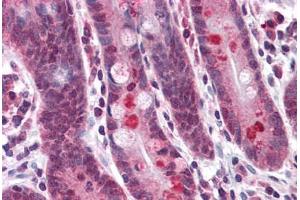 Human Small Intestine: Formalin-Fixed, Paraffin-Embedded (FFPE) (Anoctamin 2 抗体  (N-Term))