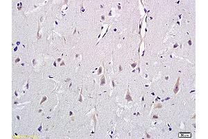 Formalin-fixed and paraffin embedded rat brain labeled with Anti-CD146/MCAM Polyclonal Antibody, Unconjugated (ABIN732143) at 1:400 followed by conjugation to the secondary antibody and DAB staining (MCAM 抗体  (AA 201-300))