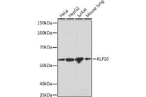 Western blot analysis of extracts of various cell lines, using KLF10 Rabbit mAb (ABIN7268150) at 1:1000 dilution. (KLF10/TIEG1 抗体)