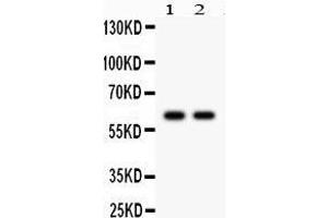 Western Blotting (WB) image for anti-Cytochrome P450, Family 1, Subfamily B, Polypeptide 1 (CYP1B1) (AA 255-480) antibody (ABIN3042785)
