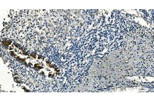 IHC analysis of IDH2 using anti-IDH2 antibody (ABIN7602786).