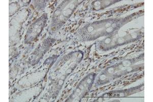 Immunoperoxidase of monoclonal antibody to RGS3 on formalin-fixed paraffin-embedded human small Intestine. (RGS3 抗体  (AA 1-192))