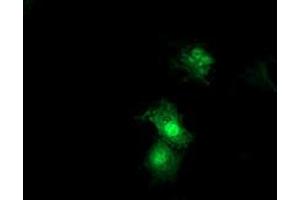 Anti-SDS mouse monoclonal antibody (ABIN2455362) immunofluorescent staining of COS7 cells transiently transfected by pCMV6-ENTRY SDS (RC217814). (serine Dehydratase 抗体)