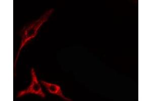 ABIN6274689 staining HepG2 cells by IF/ICC. (Laminin beta 1 抗体  (C-Term))