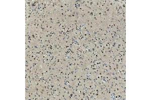 IHC analysis of SNRNP27 using anti-SNRNP27 antibody (ABIN7599614).