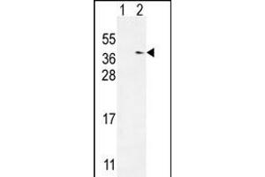 Western blot analysis of TXNDC6 (arrow) using rabbit polyclonal TXNDC6 Antibody (Center) (ABIN654968 and ABIN2844606). (NME9 抗体  (AA 111-139))