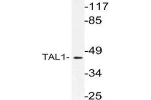 Western blot analysis of TAL1 Antibody in extracts from Jurkat cells. (TAL1 抗体)