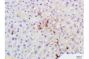Formalin-fixed and paraffin embedded mouse liver labeled with Rabbit Anti phospho-GCN2 (Thr667) Polyclonal Antibody, Unconjugated  at 1:200 followed by conjugation to the secondary antibody and DAB staining (GCN2 抗体  (pThr667))