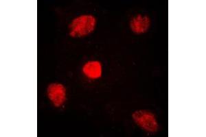 Immunofluorescent analysis of TRAP220 staining in HuvEc cells. (MED1 抗体  (Center))