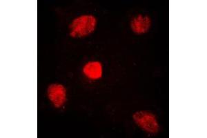 Immunofluorescent analysis of TRAP220 staining in HuvEc cells.