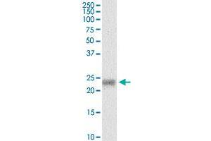 MYL5 monoclonal antibody (M03), clone 3D12. (MYL5 抗体  (AA 4-96))