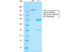 SDS-PAGE Analysis Purified Wilm's Tumor Mouse Recombinant Monoclonal Antibody (rWT1/857). (Recombinant WT1 抗体)