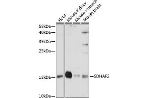 Western blot analysis of extracts of various cell lines, using SDH antibody (ABIN7270619) at 1:1000 dilution. (Sdhaf2 抗体  (AA 1-166))