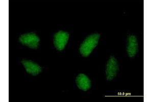 Immunofluorescence of purified MaxPab antibody to MAPK11 on HeLa cell. (MAPK11 抗体  (AA 1-364))