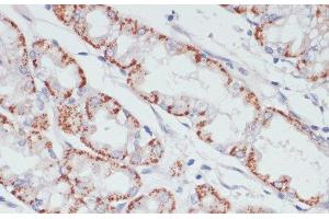 Immunohistochemistry of paraffin-embedded Human stomach using ACSL3 Polyclonal Antibody at dilution of 1:100 (40x lens). (Acsl3 抗体)