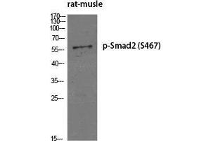 Western Blot (WB) analysis of specific cells using Phospho-Smad2 (S467) Polyclonal Antibody. (SMAD2 抗体  (pSer467))