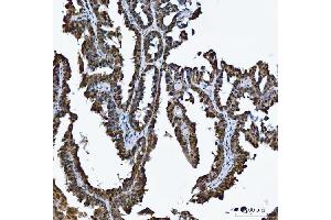 IHC analysis of TRMT10C using anti-TRMT10C antibody (ABIN7601472).