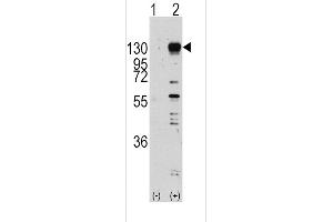 Western blot analysis of FGFR1 (arrow) using rabbit polyclonal FGFR1 Antibody  (R). (FGFR1 抗体  (AA 631-660))