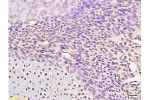 Formalin-fixed and paraffin embedded mouse embryo labeled with Rabbit Anti AP2 gamma Polyclonal Antibody, Unconjugated (ABIN720056) at 1:200 followed by conjugation to the secondary antibody and DAB staining (TFAP2C 抗体  (AA 2-100))