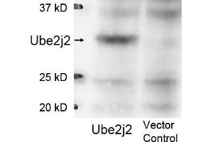 Image no. 1 for anti-Ubiquitin-Conjugating Enzyme E2, J2 (UBE2J2) (Internal Region) antibody (ABIN401475) (UBE2J2 抗体  (Internal Region))