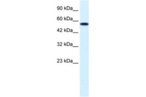 Western Blotting (WB) image for anti-Checkpoint Kinase 1 (CHEK1) antibody (ABIN2460510) (CHEK1 抗体)