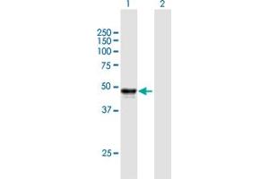 Western Blot analysis of SERPINH1 expression in transfected 293T cell line by SERPINH1 MaxPab polyclonal antibody. (SERPINH1 抗体  (AA 1-418))