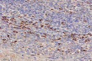 Immunohistochemistry (Paraffin-embedded Sections) (IHC (p)) image for anti-Colony Stimulating Factor 2 Receptor, Beta (CSF2RB) antibody (ABIN7073557)