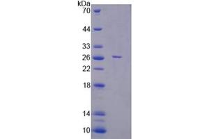 Image no. 1 for F-Box Protein 32 (FBXO32) (AA 1-201) protein (His tag) (ABIN6237452) (FBXO32 Protein (AA 1-201) (His tag))