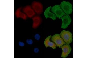 ABIN6257450 and ABIN6275471 staining Hela cells(30 min of UV treatment) by IF/ICC. (RAB6A 抗体  (Internal Region))