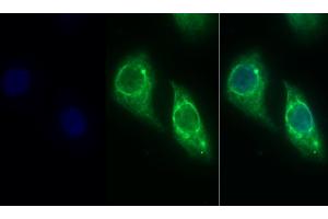 Detection of CK19 in Human Hela cell using Monoclonal Antibody to Cytokeratin 19 (CK19) (Cytokeratin 19 抗体  (AA 245-391))