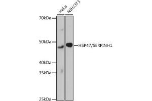 Western blot analysis of extracts of various cell lines, using HSP47/SERPINH1 Rabbit mAb (ABIN7270238) at 1:1000 dilution. (SERPINH1 抗体)