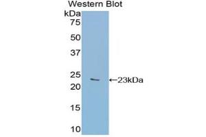 Western blot analysis of the recombinant protein. (GAA 抗体  (AA 782-953))