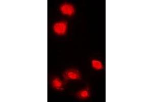 Immunofluorescent analysis of AMPK alpha 1 staining in HeLa cells. (PRKAA1 抗体  (C-Term))