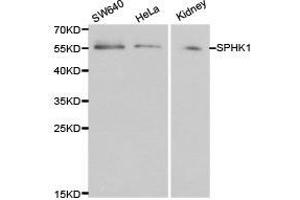 Western Blotting (WB) image for anti-Sphingosine Kinase 1 (SPHK1) antibody (ABIN1874920)