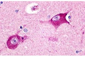 Image no. 1 for anti-Histamine Receptor H3 (HRH3) (Cytoplasmic Domain) antibody (ABIN1048961) (HRH3 抗体  (Cytoplasmic Domain))