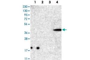 Western Blot analysis of Lane 1: RT-4 cell, Lane 2: U-251 MG sp cell, Lane 3: human plasma tissue (IgG/HSA depleted) and Lane 4: human liver tissue lysates with CNTLN polyclonal antibody . (CNTLN 抗体)