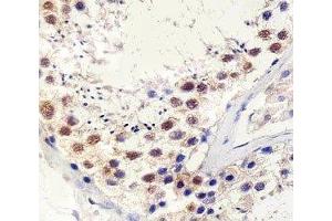 Immunohistochemical analysis of paraffin-embedded human testis using TBP antibody at 1:25 dilution. (TBP 抗体)