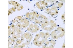 Immunohistochemistry of paraffin-embedded Human stomach using SMEK1 Polyclonal Antibody at dilution of 1:100 (40x lens). (SMEK1 抗体)