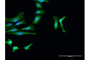 Immunofluorescence (IF) image for anti-Protein tyrosine Phosphatase, Non-Receptor Type 2 (PTPN2) (AA 1-387) antibody (ABIN519504)