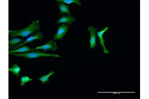 Immunofluorescence of purified MaxPab antibody to PTPN2 on HeLa cell. (PTPN2 抗体  (AA 1-387))