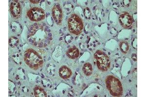 This image was kindly submitted by Horea Rus of the University of Maryland. (RGC32 抗体  (AA 98-137))
