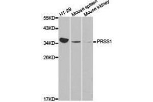 Western Blotting (WB) image for anti-Protease, serine, 1 (Trypsin 1) (PRSS1) antibody (ABIN1874350) (PRSS1 抗体)